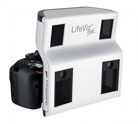 LifeViz 3D Imaging System (Франция)
