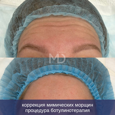 Фото до и после