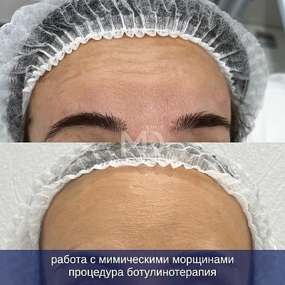 Фото до и после
