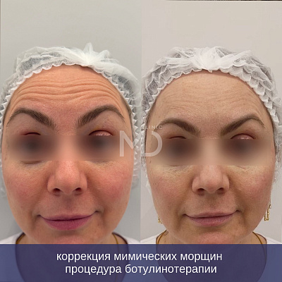 Фото до и после