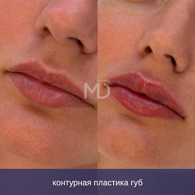 Фото до и после