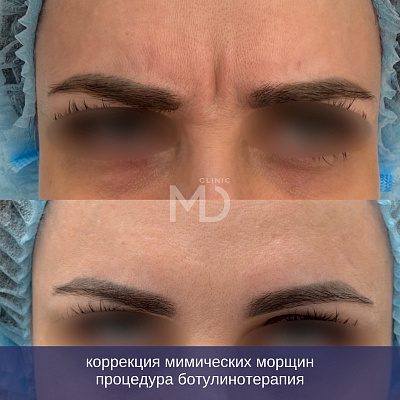Фото до и после