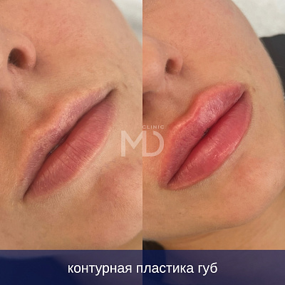 Фото до и после