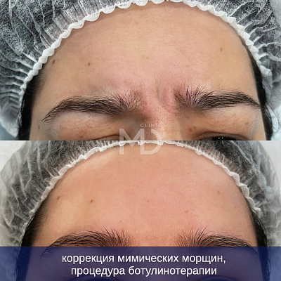 Фото до и после