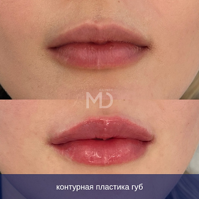 Фото до и после