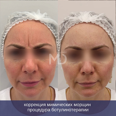 Фото до и после