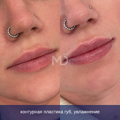 Фото до и после