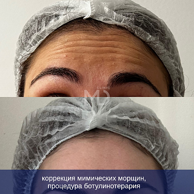 Фото до и после