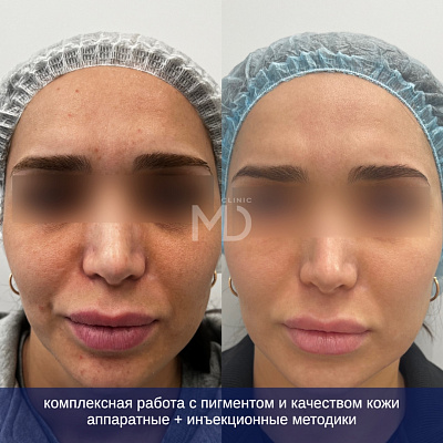 Фото до и после