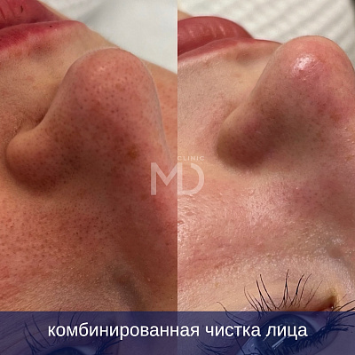 Фото до и после