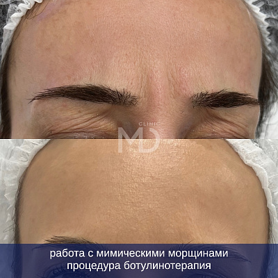 Фото до и после