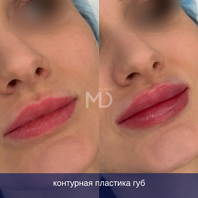 Фото до и после